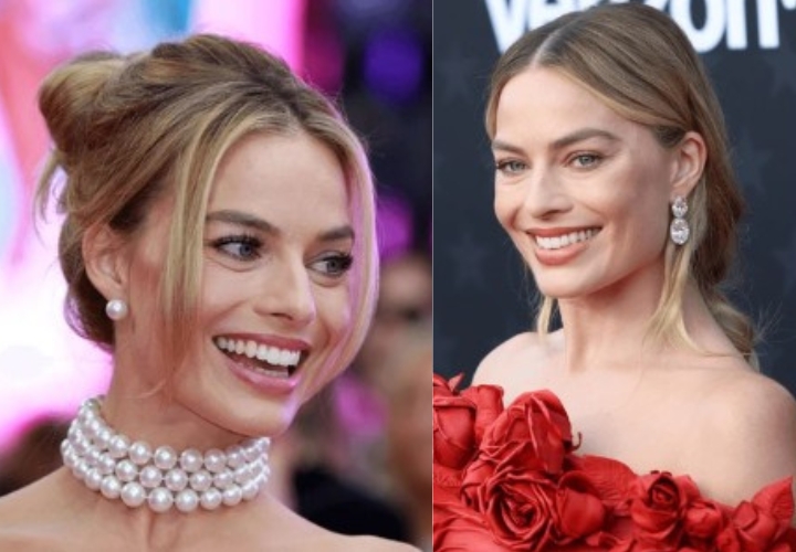 Margot Robbie’s Teeth celebrity veneers before and after Antalya, Turkey